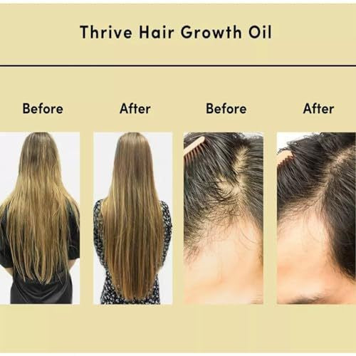 Veganic Scalp Wellness Oil